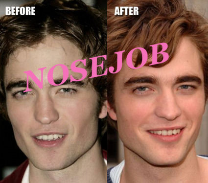  Pattinson Plastic Surgery on Kanske Ingen Surprise  Eller  Holywood   R Hollywood  And It Always